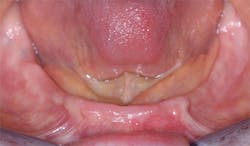 1501dechr P03 1501dechr P03