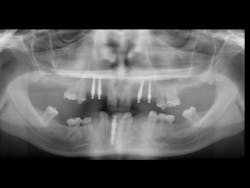 1503dechr P04 1503dechr P04