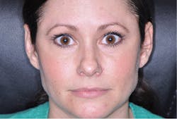 1503demal P04 1503demal P04