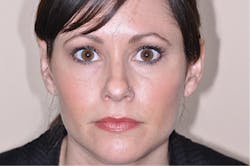 1503demal P07 1503demal P07