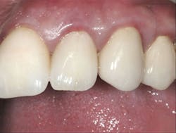 1504dechr P021 1504dechr P021