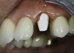 1504dechr P0211 1504dechr P0211