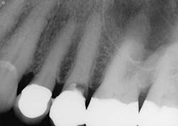 1504dechr P03 1504dechr P03