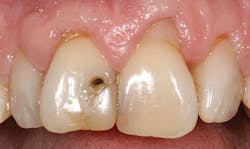 1504denot P01 1504denot P01