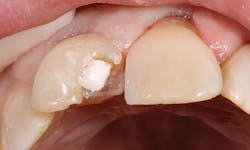 1504denot P02 1504denot P02