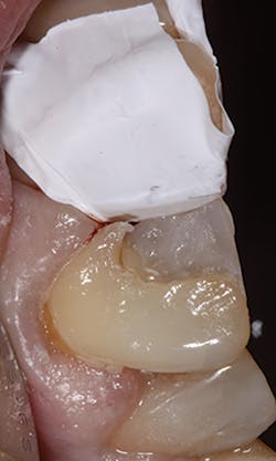 1504denot P03 1504denot P03