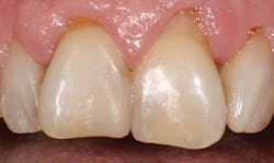 1504denot P04 1504denot P04