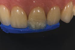 1504denot P08 1504denot P08