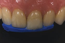 1504denot P09 1504denot P09