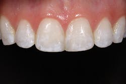 1504denot P12 1504denot P12