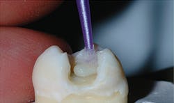 1504depre P01 1504depre P01