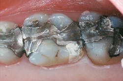 1504depre P02 1504depre P02