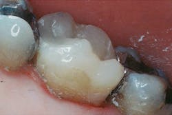 1504depre P03 1504depre P03