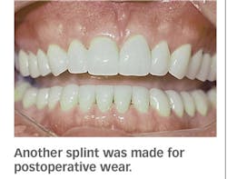 1505de 851 1505de 851