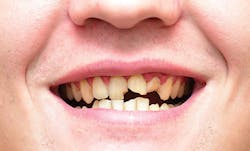 1505dechr P01 1505dechr P01