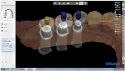 1506decul P03 1506decul P03