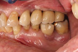 1506decul P06 1506decul P06