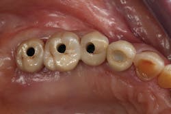 1506decul P07 1506decul P07