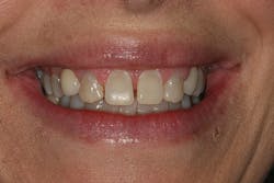 1506derow P01 1506derow P01