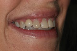 1506derow P02 1506derow P02