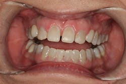 1506derow P03 1506derow P03