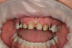 1506derow P04 1506derow P04