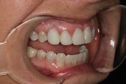 1506derow P09 1506derow P09