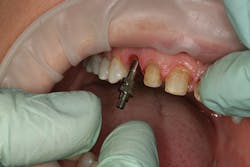 1506derow P11 1506derow P11