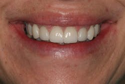 1506derow P17 1506derow P17