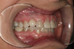 1506derow P18 1506derow P18