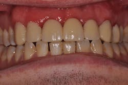 1506desal P01 1506desal P01