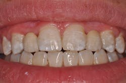 1506desal P02b 1506desal P02b