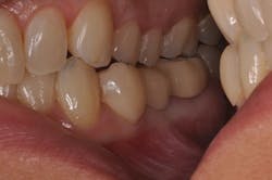 1506desal P03a 1506desal P03a