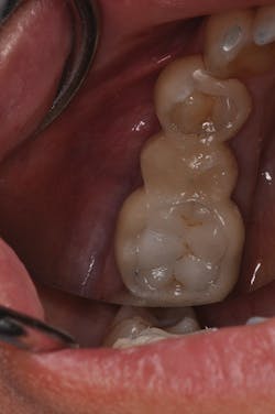 1506desal P03b 1506desal P03b