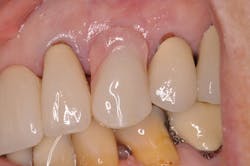 1506desal P05 1506desal P05