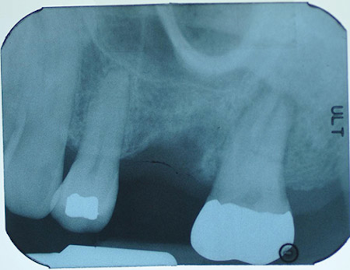 1506deshe P01