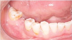 1506desil P01 1506desil P01