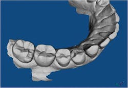 1506desil P02 1506desil P02