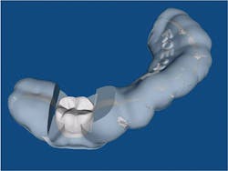 1506desil P03 1506desil P03