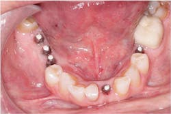 1506desil P04 1506desil P04