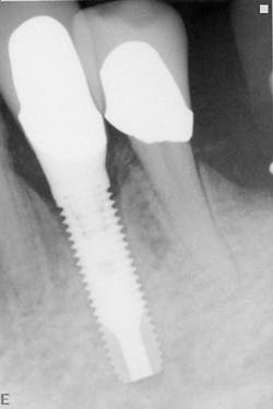 1506deyoo P05 1506deyoo P05