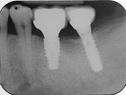 1506deyoo P07 1506deyoo P07