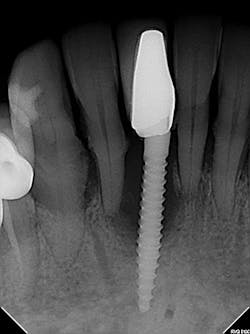 1506deyoo P10 1506deyoo P10