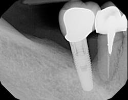 1506deyoo P11 1506deyoo P11