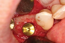 1506deyoo P12 1506deyoo P12