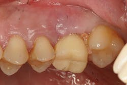 1506deyoo P13 1506deyoo P13