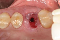 1506deyoo P15 1506deyoo P15