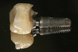 1506deyoo P16 1506deyoo P16