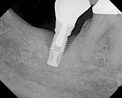 1506deyoo P17 1506deyoo P17