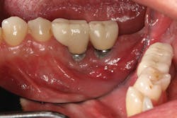 1506deyoo P18 1506deyoo P18